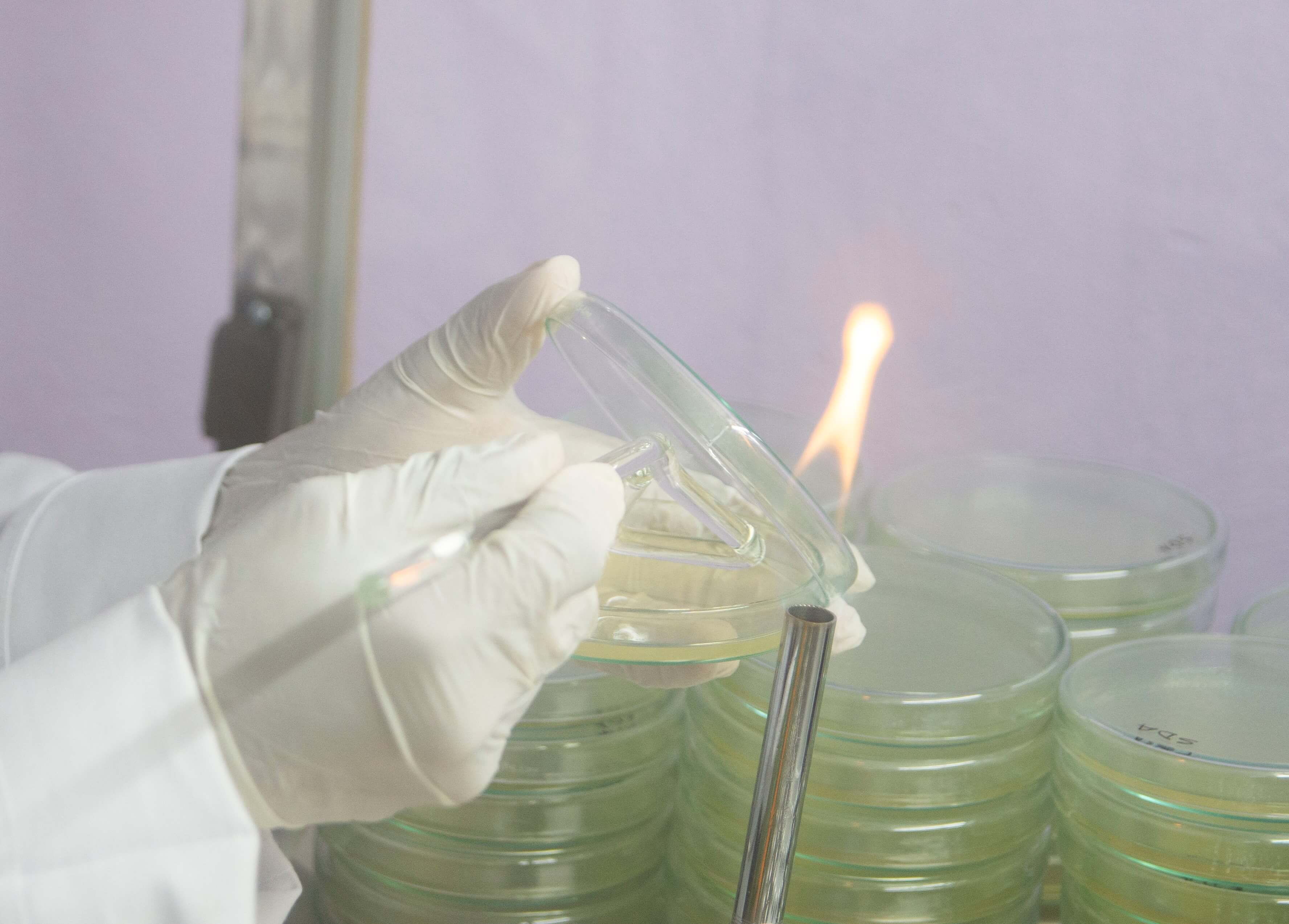 Hands on Training on Microbiological Laboratory Techniques